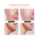 Massageador Facial Redutor de Papadas, Rugas e Flacidez
